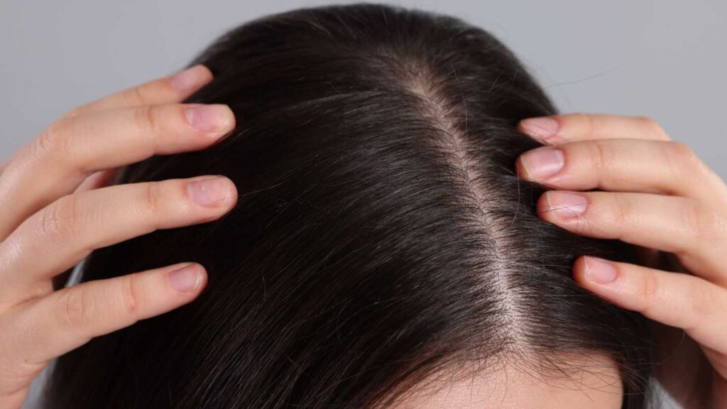 Peroxide in Hair Colour: 5 Facts You Should Know - Image 2
